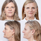 SUSANNAH CONSTANTINE, 63, CHOOSES THE NEW ALMA HARMONY BIO-BOOST™ FOR MID-LIFE SKIN CONFIDENCE